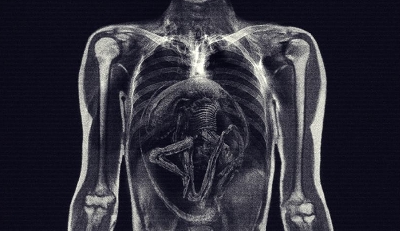 Alien: Covenant X-Ray Images Hint at Big Plot Detail!